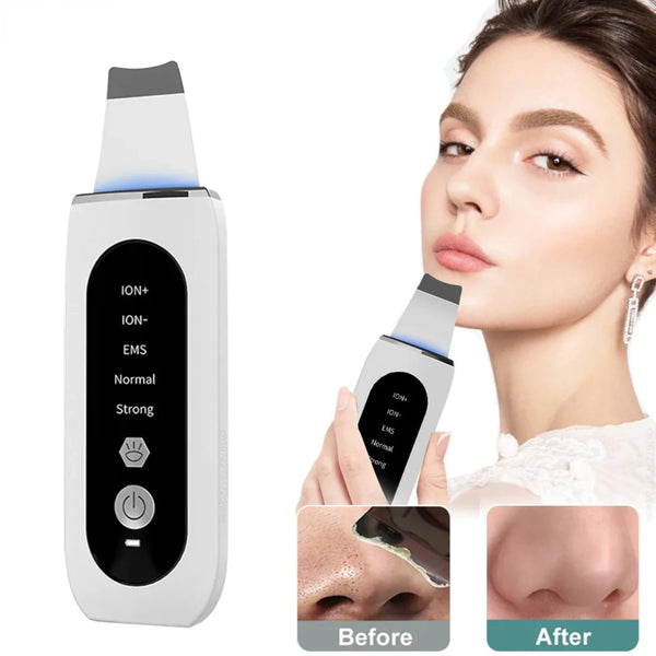 Ultrasonic Skin Scrubber
